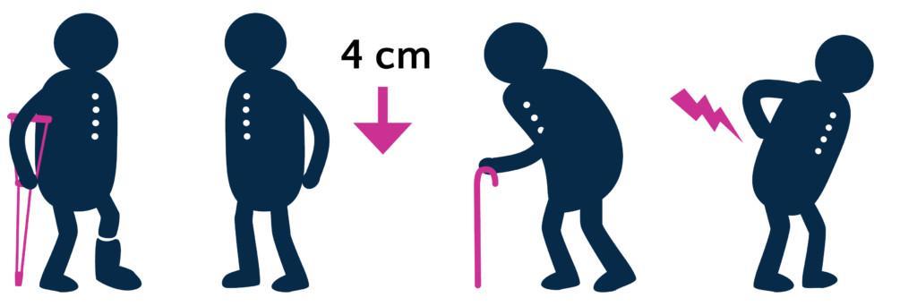 4 piirroshahmoa: kainalosauvaa käyttävä, jolla on jalassa kipsi, 4 cm lyhentynyt, kumarassa kävelykepin kanssa kulkeva sekä selkäkivusta kärsivä.